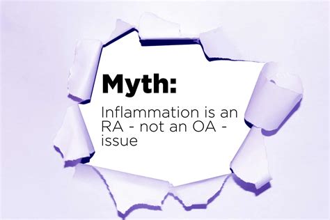 Myths About Osteoarthritis You Should Ignore