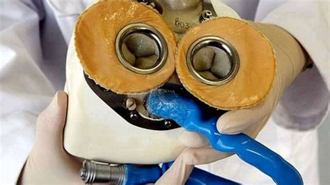 When a Government Hospital Became a Lifesaver: The Story of India s ...