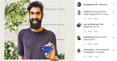 Rana Daggubati’s Latest Picture Has Left Fans Worried About His Health ...
