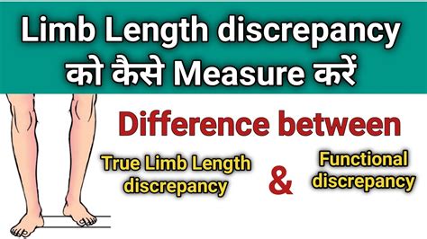 Measure Leg Length Discrepancy 的图像结果