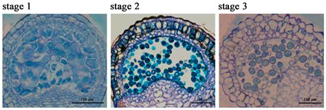Transcriptomic and GC-MS Metabolomic Analyses Reveal the Sink Strength ...