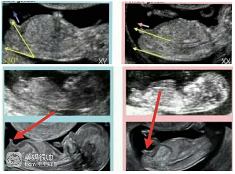 双暖双胎的B超图片，图片分别是怀孕6周，7周B超图，请大家帮看看是不是双胞？？另一个存活的几率大吗？ - 百度宝宝知道