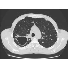 Buy HARRISON'S PRINCIPLES OF INTERNAL MEDICINE – 2 VOLUMES | 21st ...