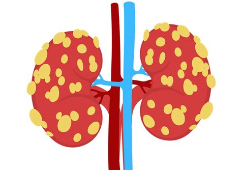 Dr. Aravinth Kumar – Nephrologist