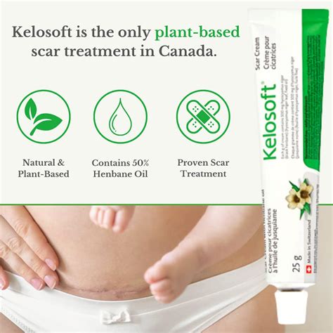Buy Kelosoft - Natural Scar Remover, Keloid Scar Removal Cream, Plant ...