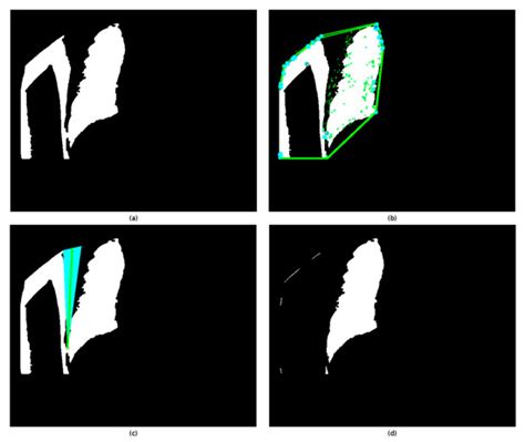 Lung Field Segmentation in Chest X-rays: A Deformation-Tolerant ...