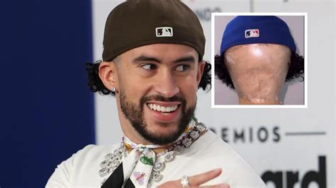 The reason Bad Bunny had to wear a wig for the past two months: See pics