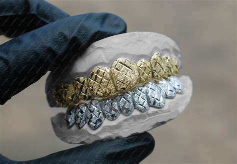 Gold Grillz With Diamond Dust at Viola Joy blog