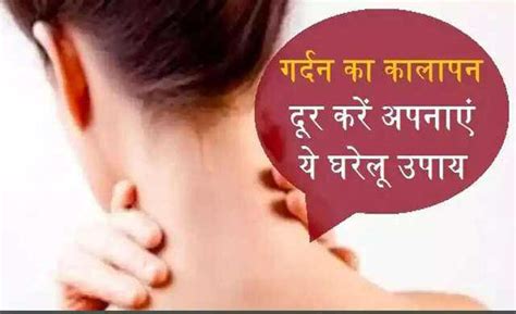Effective natural remedies for dark neck skin