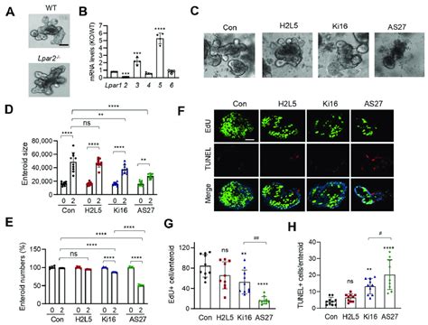 Image result for What Is LPAR