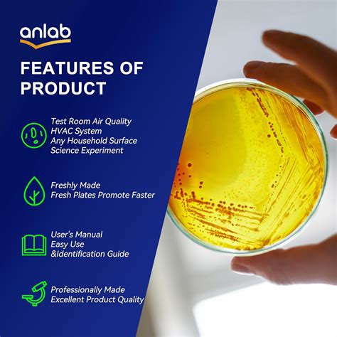 anlab™ Nutrient Agar Petri Dishes Science Project India | Ubuy