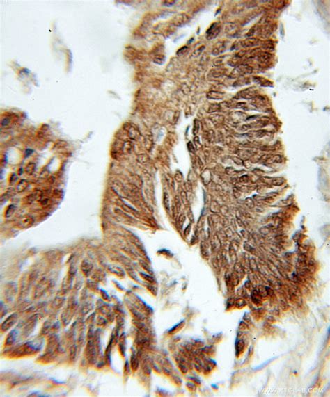 PFDN1 antibody (11033-2-AP) | Proteintech