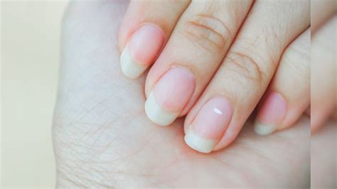 नखांवर का येतात असे पांढरे डाग? त्यांच्याकडे दुर्लक्ष करण्याची चुक करु ...