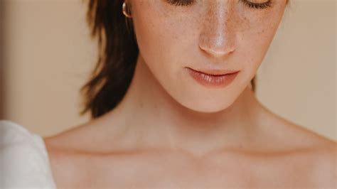 What is Melasma? How can it be treated? – Minimalist