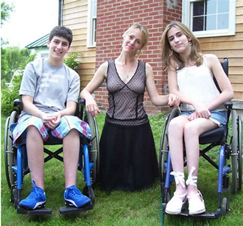 Friedreich's ataxia causes, gene, symptoms, prognosis and treatment