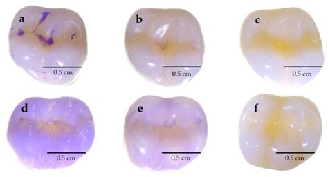 Postbiotic Metabolite of Lactiplantibacillus plantarum PD18 against ...