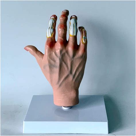 Qulong Palm Anatomy Models The Anatomical Structure Of The Painful ...