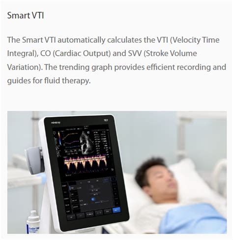 Image result for Mindray Te7 Measurements Tutorial