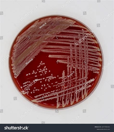 Staphylococcus Aureus Growing Blood Agar Stock Photo 2277765321 ...