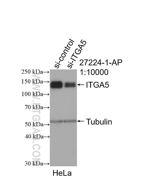 Integrin alpha-5/CD49e antibody (27224-1-AP) | Proteintech