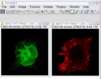 ImageJ Colocalization Analysis 的图像结果