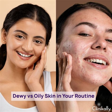 Is Your Skin Glowing or Just Oily: Skincare Tips for Dewy Skin