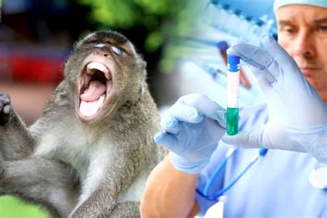 Monkey Fever: मंकी फीवर का बढ़ता कहर, एक और महिला की हुई मौत, मृतकों की ...