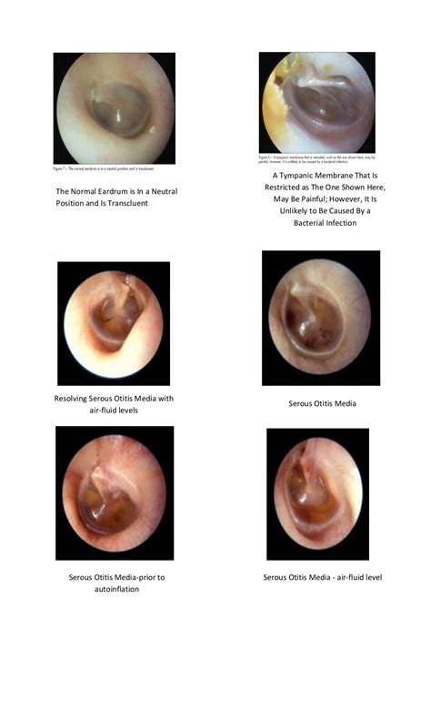 Tympanic membrane dr. fadil
