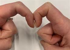 Finger Picture by This Simple Finger Test Could Reveal Signs Of Lung Cancer Finger Picture