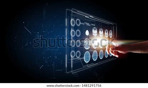 Image result for X-ray Technology