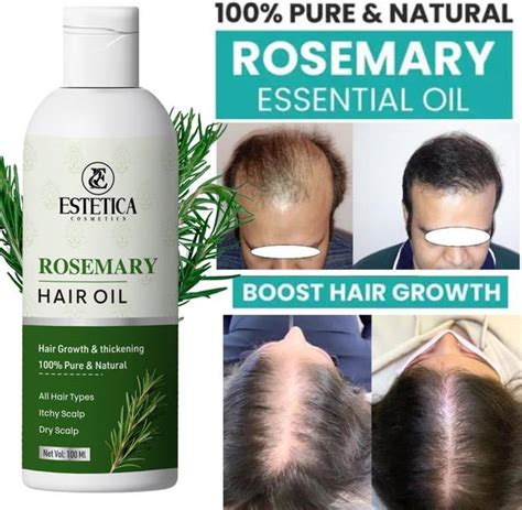 Buy Rosemary Oil for Hair & Skin Online | Flipkart