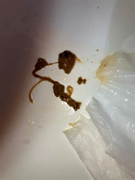 String like thing in poop. : r/poop