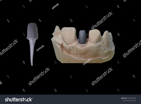 Image result for Metalcasting Core