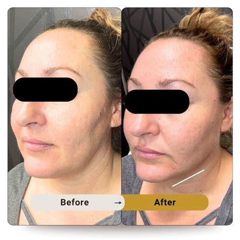 Image result for Face Threads