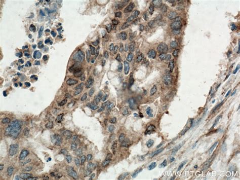 KRAS antibody (12063-1-AP) | Proteintech