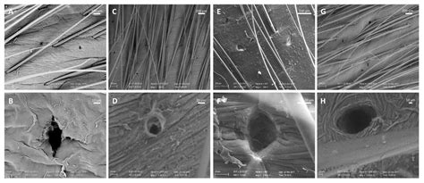 Nanosuspensions and Microneedles Roller as a Combined Approach to ...