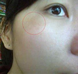 【图】脸上长斑位置图解 弄清原因才能对症下药_长斑_伊秀美容网|yxlady.com