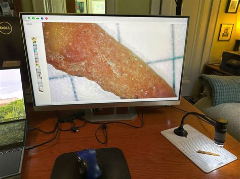 Image result for Use of Plugable Digital Microscope in Windows