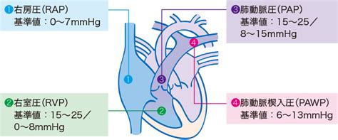 肺循環障害 | 看護roo![カンゴルー]