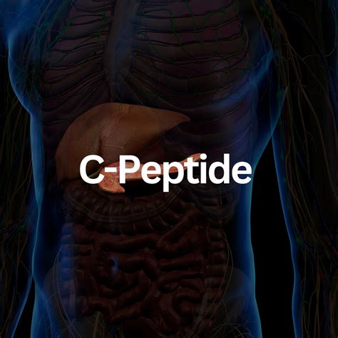 C Peptide – M&M Labs