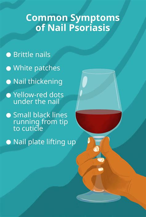 Nail Psoriasis: Causes, Symptoms, Diagnosis, Treatment