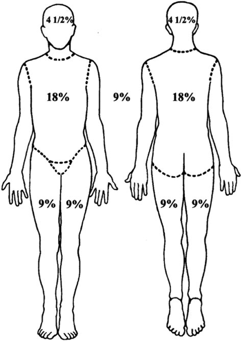 Assessment and Management of Acute Burn Injuries - Physical Medicine ...