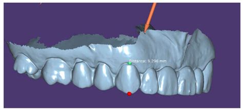 Bioengineering Applied to Oral Implantology, a New Protocol: “Digital ...