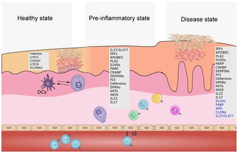 Review—Current Concepts in Inflammatory Skin Diseases Evolved by ...