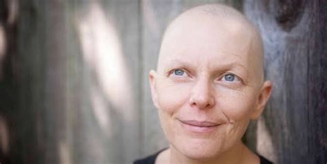 What Are The Common Side Effects Of Chemotherapy? | OnlyMyHealth