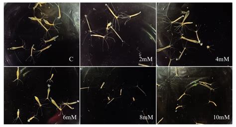 Department of Biotechnology & Microbiology | National College, Trichy