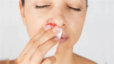 From Nose Bleeds To Joint Pains - Dangerous Side Effects Of Vitamin K ...