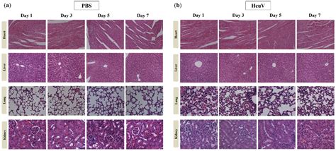 Preparation and Evaluation of a Horse Antiserum against the Venom of ...