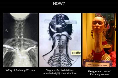 Tightened vaginas to elongated necks: so much for men's pleasure