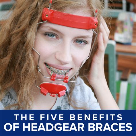Headgear Braces | Chamblee Orthodontics | Atlanta, GA